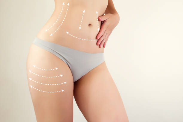 When is the best time for Liposuction?