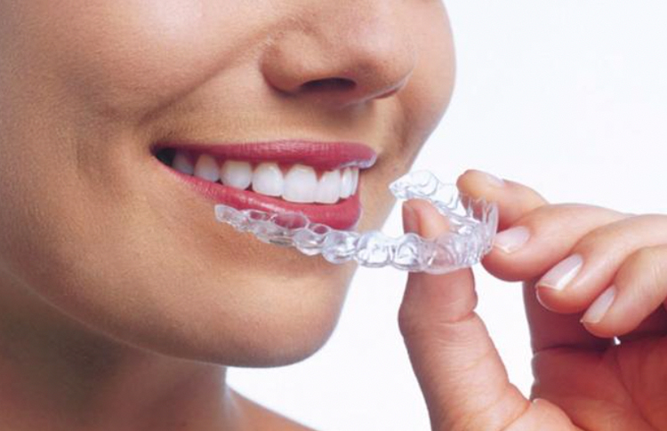 Invisalign Cost: How to Make Treatment More Affordable