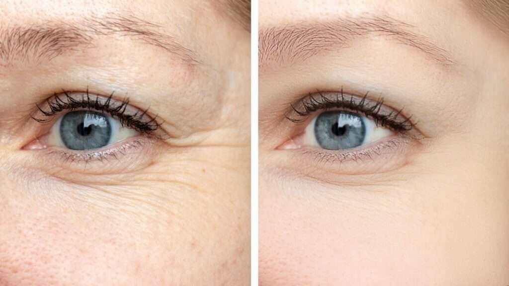 Eye Cream for Wrinkles Truffoire.com