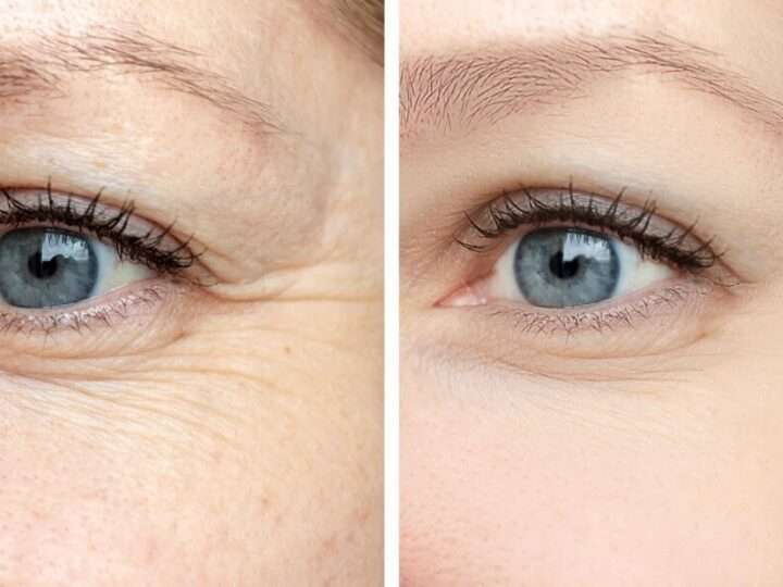 10 Powerful Benefits of Using Eye Cream for Wrinkles Truffoire.com