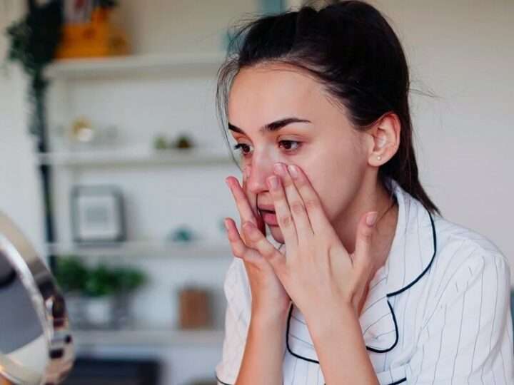 Rosacea and Acne: why it’s important not to ignore symptoms and how to deal with them at home