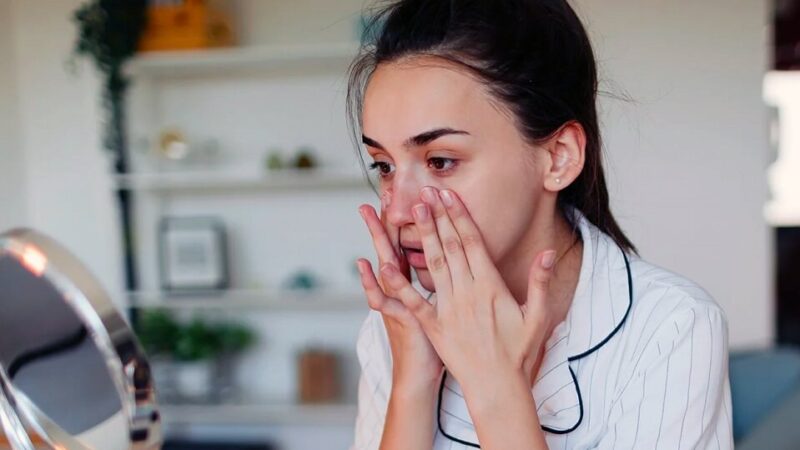 Rosacea and Acne: why it’s important not to ignore symptoms and how to deal with them at home
