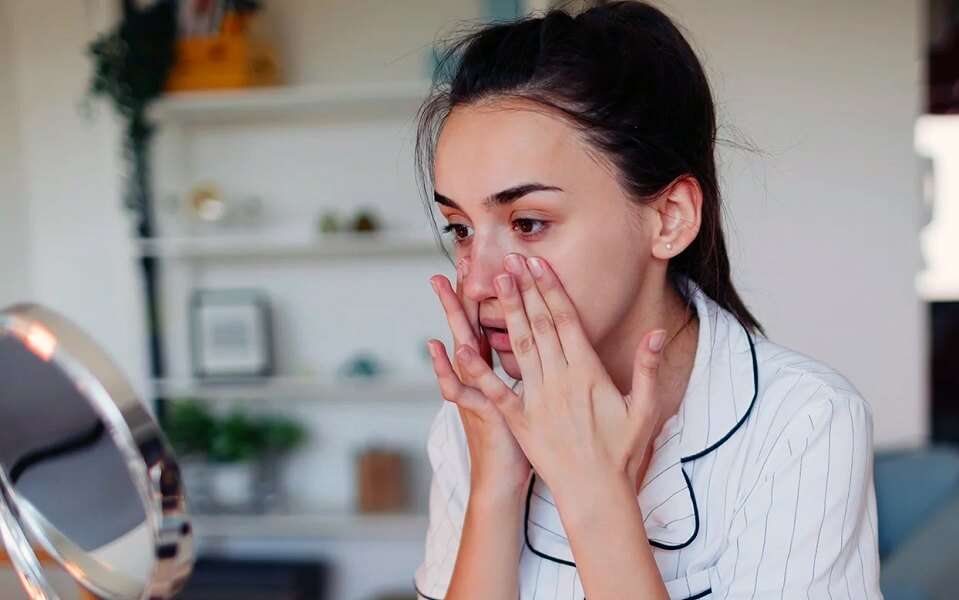 Rosacea and Acne: why it’s important not to ignore symptoms and how to deal with them at home